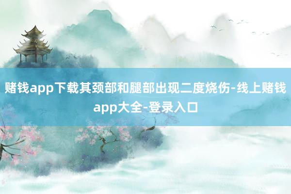 赌钱app下载其颈部和腿部出现二度烧伤-线上赌钱app大全-登录入口